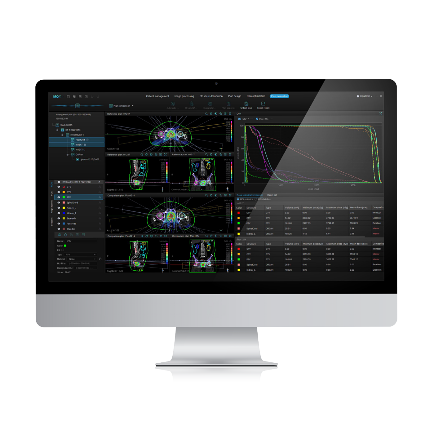 Mozi_radiotherapy_planning_system_product