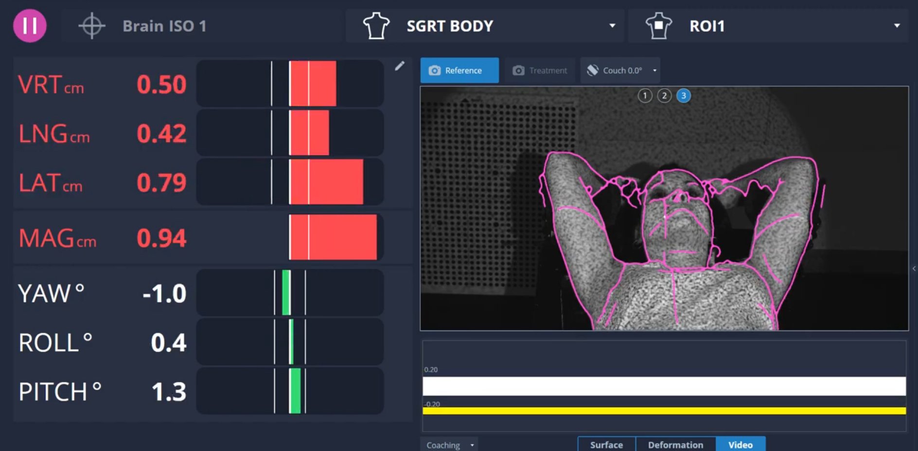Postural-video
