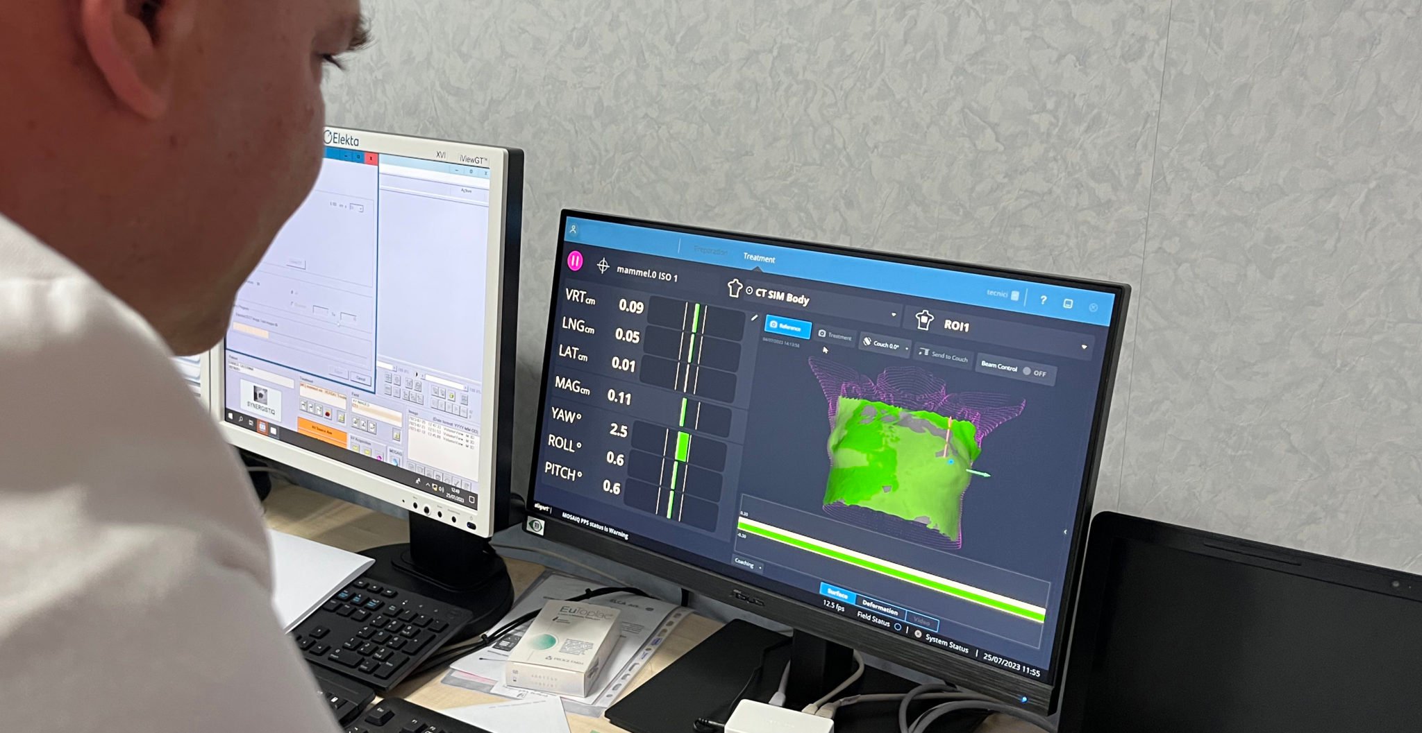 Radiosurgery-Agropoli_posizionamento_monitoraggio-VisionRT_3-2048x1057