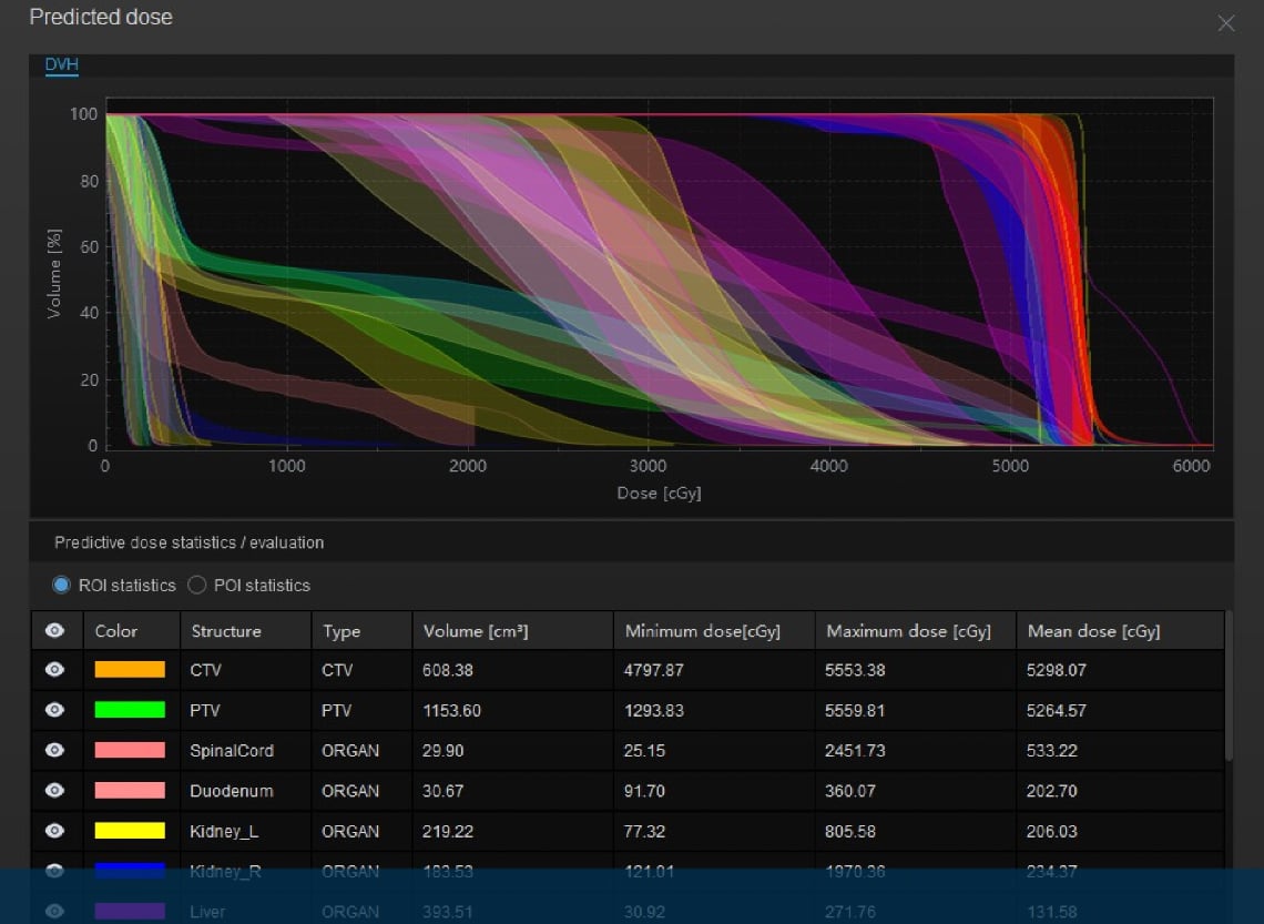 Mozi_TPS_Treatment_Planning_System_featured