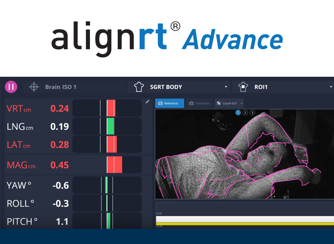 Presentazione AlignRT Advance